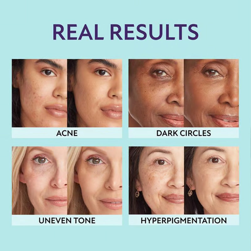 🎉All-in-one moisturizer, concealer and coverage 💧✨ Lightweight and waterproof